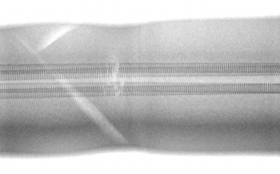 Element Disconnection Part Image